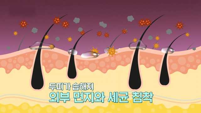 좋은아침