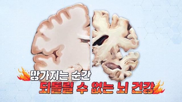 죽음보다 두려운 치매