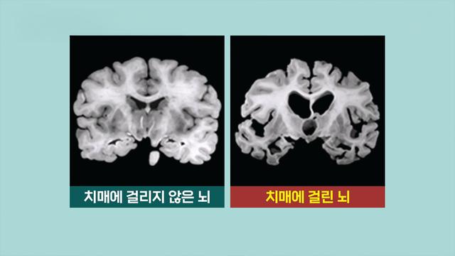 똑똑똑! 고민상담소