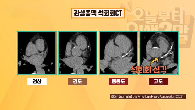 오늘부터 인생 2막